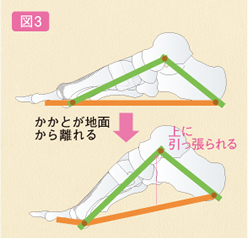 ウインドラスメカニズム