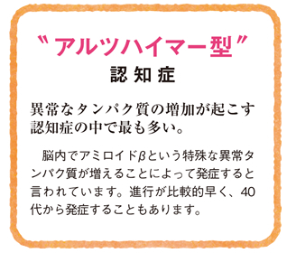 アルツハイマー型認知症