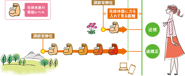 図2：毛様体筋への力の入り方