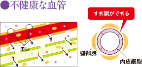 不健康な血管
