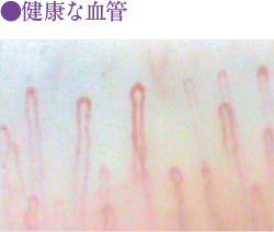 健康な血管