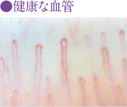健康な血管