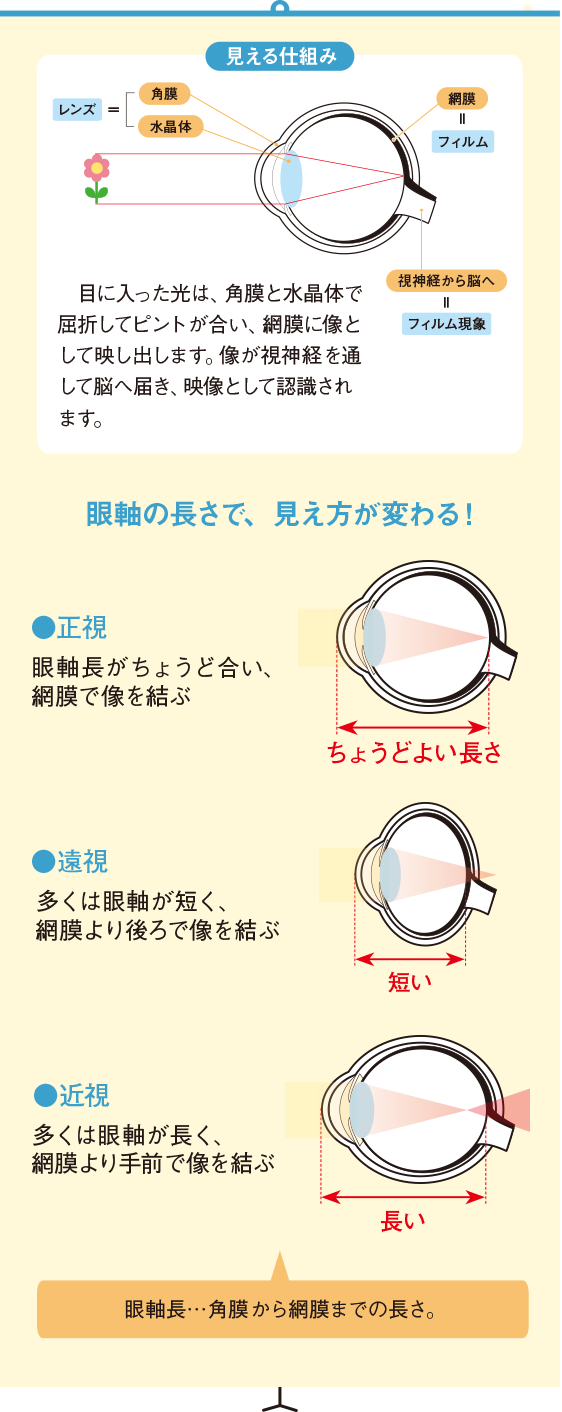 眼軸の長さで、見え方が変わる！正視 眼軸長がちょうど合い、網膜を像が結ぶ ちょうど良い長さ　遠視 多くは眼軸が短く、網膜より後ろで像を結ぶ 短い 近視 多くは眼軸が長く、網膜より手前で像を結ぶ 長い 眼軸長・・・角膜の頂点から網膜までの長さ。　見える仕組み 目に入った光は、角膜と水晶体で屈折してピントが合い、網膜に像として映し出します。像が視神経を通してのうへ届き、映像として認識されます。