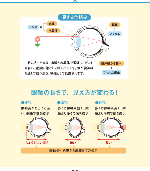 眼軸の長さで、見え方が変わる！正視 眼軸長がちょうど合い、網膜を像が結ぶ ちょうど良い長さ　遠視 多くは眼軸が短く、網膜より後ろで像を結ぶ 短い 近視 多くは眼軸が長く、網膜より手前で像を結ぶ 長い 眼軸長・・・角膜の頂点から網膜までの長さ。　見える仕組み 目に入った光は、角膜と水晶体で屈折してピントが合い、網膜に像として映し出します。像が視神経を通してのうへ届き、映像として認識されます。