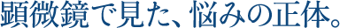 顕微鏡で見た、悩みの正体。