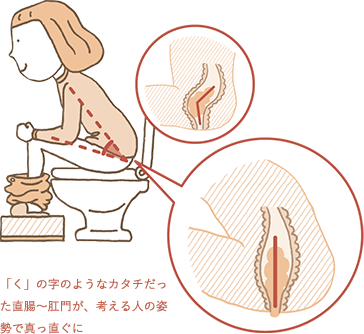 排便するときは考える人の姿勢で