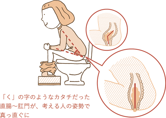 排便するときは考える人の姿勢で