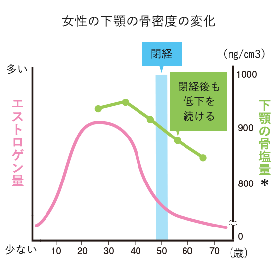 骨密度の低下は顎の骨にも！