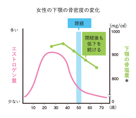 骨密度の低下は顎の骨にも！