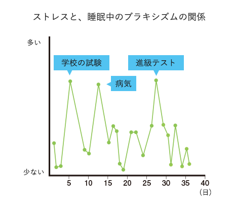 強いストレスで噛み締めが増加