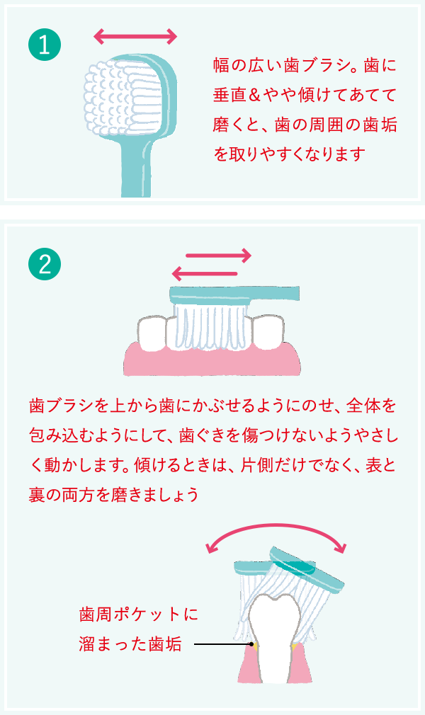 1 幅の広い歯ブラシ。歯に垂直＆やや傾けてあてて磨くと、歯の周囲の歯垢を取りやすくなります 2 歯ブラシを上から歯にかぶせるようにのせ、全体を包み込むようにして、歯ぐきを傷つけないようやさしく動かします。傾けるときは、片側だけでなく、表と裏の両方を磨きましょう