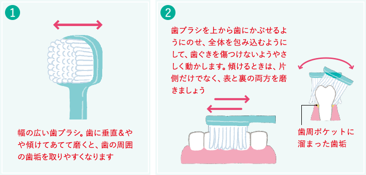 1 幅の広い歯ブラシ。歯に垂直＆やや傾けてあてて磨くと、歯の周囲の歯垢を取りやすくなります 2 歯ブラシを上から歯にかぶせるようにのせ、全体を包み込むようにして、歯ぐきを傷つけないようやさしく動かします。傾けるときは、片側だけでなく、表と裏の両方を磨きましょう